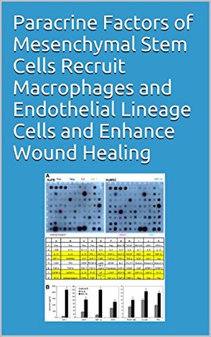[ab04b] ~R.e.a.d@ Paracrine Factors of Mesenchymal Stem Cells Recruit Macrophages and Endothelial Lineage Cells and Enhance Wound Healing - Various #P.D.F@