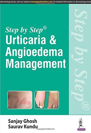 [14eaa] @Download# Step by Step: Urticaria & Angioedema Management - Sanjay Ghosh ~e.P.u.b!