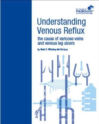 [a99b0] ^R.e.a.d@ ~O.n.l.i.n.e! Understanding Venous Reflux the Cause of Varicose Veins and Venous Leg Ulcers (College of Phlebology Book 1) - Mark S. Whiteley %P.D.F~